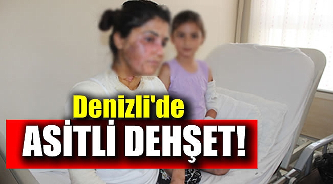 Denizli'de asitli dehşet