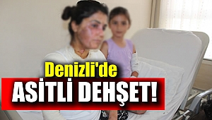 Denizli'de asitli dehşet