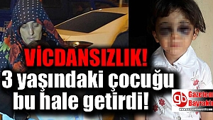 3 yaşındaki üvey kızını bu hale getirdi