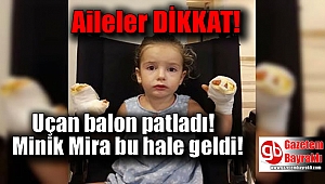 Uçan balon patladı minik Mira bu hale geldi