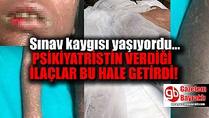 Psikiyatristin verdiği ilaçlar yüzünden yaşam savaşı veriyor