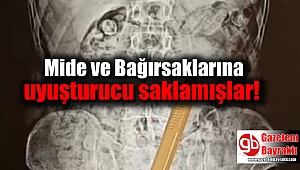 Mide ve Bağırsaklarına uyuşturucu saklamışlar