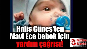 Halis Güneş'ten Mavi Ece bebek için yardım çağrısı