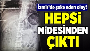 Midesinden 198 gram uyuşturucu çıktı