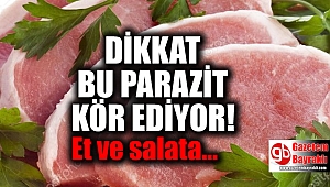 İzmir'de yaşanan olay dikkatleri bu parazite çevirdi