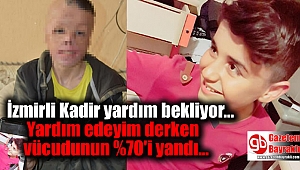 İzmirli Kadir yardım bekliyor: Yardım edeyim derken vücudunun %70'i yandı