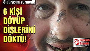 İzmir'de sigara ve bisikletini vermeyen adamın dişlerini döktüler
