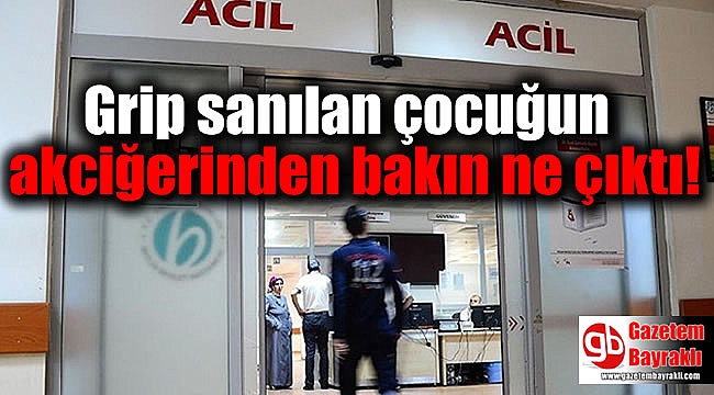 Grip sanılan çocuğun akciğerinden bakın ne çıktı