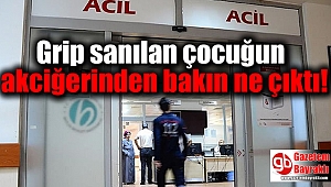 Grip sanılan çocuğun akciğerinden bakın ne çıktı