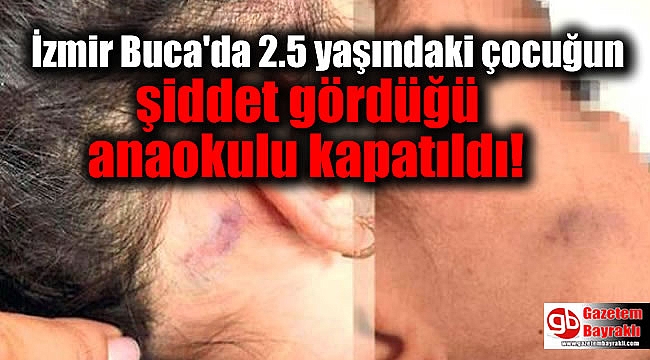 İzmir Buca'da 2.5 yaşındaki çocuğun şiddet gördüğü anaokulu kapatıldı