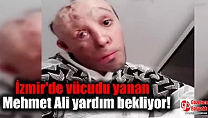 İzmir'de vücudu yanan Mehmet Ali yardım bekliyor