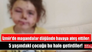 İzmir'de magandalar düğünde havaya ateş ettiler: 5 yaşındaki çocuğu bu hale getirdiler