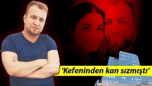 Saç ekiminde sır ölüm: Operasyon sırasında hayatını kaybetti