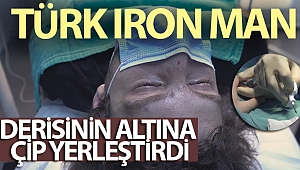 Türk Iron Man Tolga Özuygur, derisinin altına çip yerleştirdi